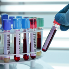 Laboratory sample tubes containing blood are being picked up by a gloved hand.